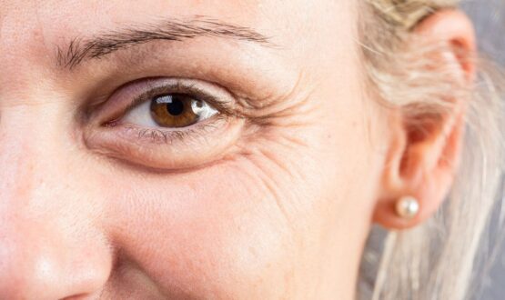 3 astuces beauté pour atténuer les rides et ridules