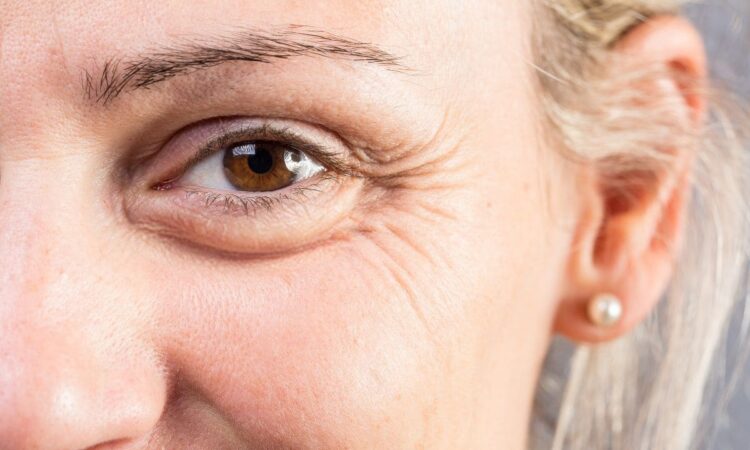 3 astuces beauté pour atténuer les rides et ridules