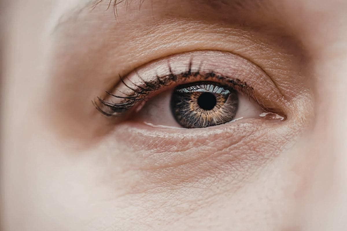 3 astuces beauté pour atténuer les rides et ridules peau fine et fragile du contour de l oeil