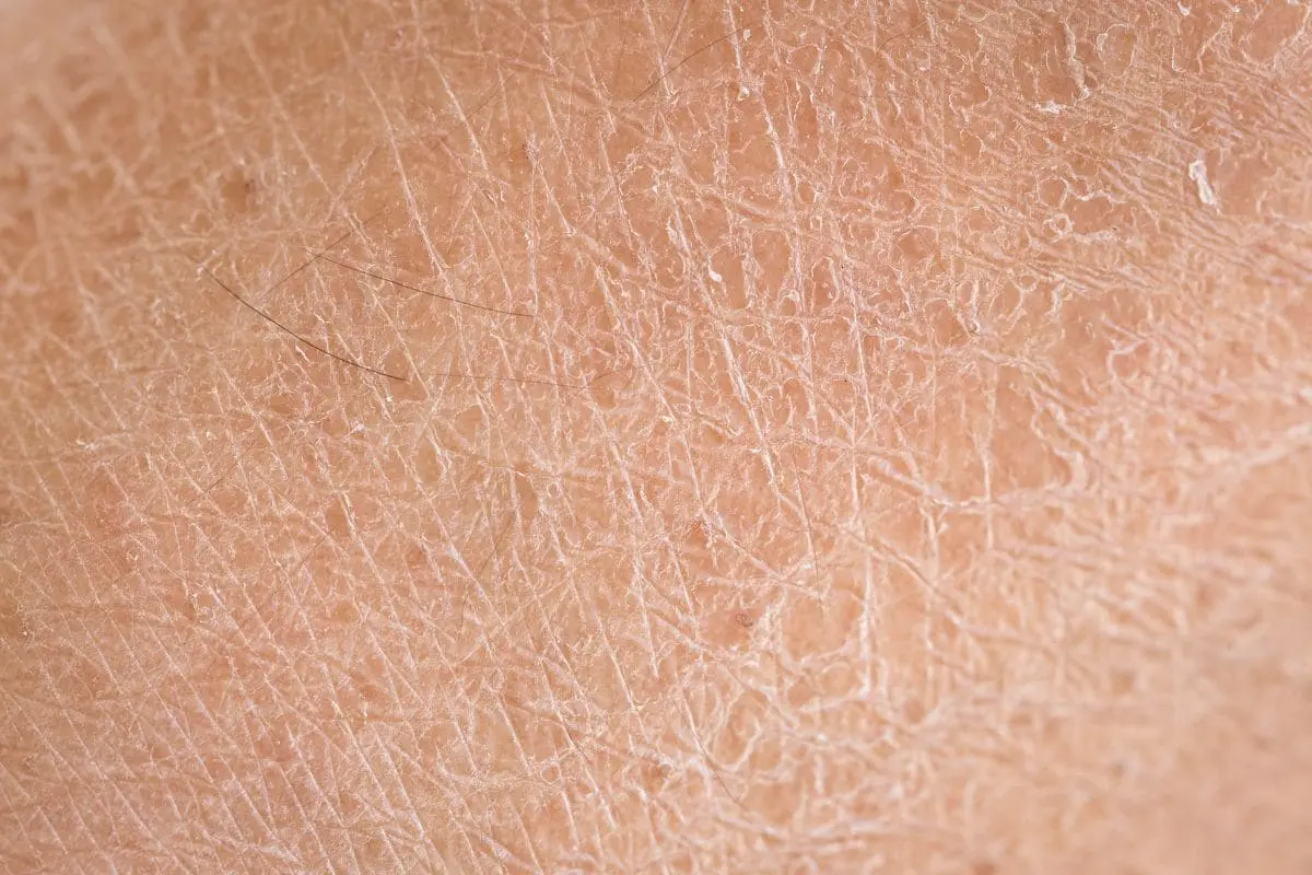 Comment construire une routine visage efficace contre le vieillissement cutané ? peau dessechee