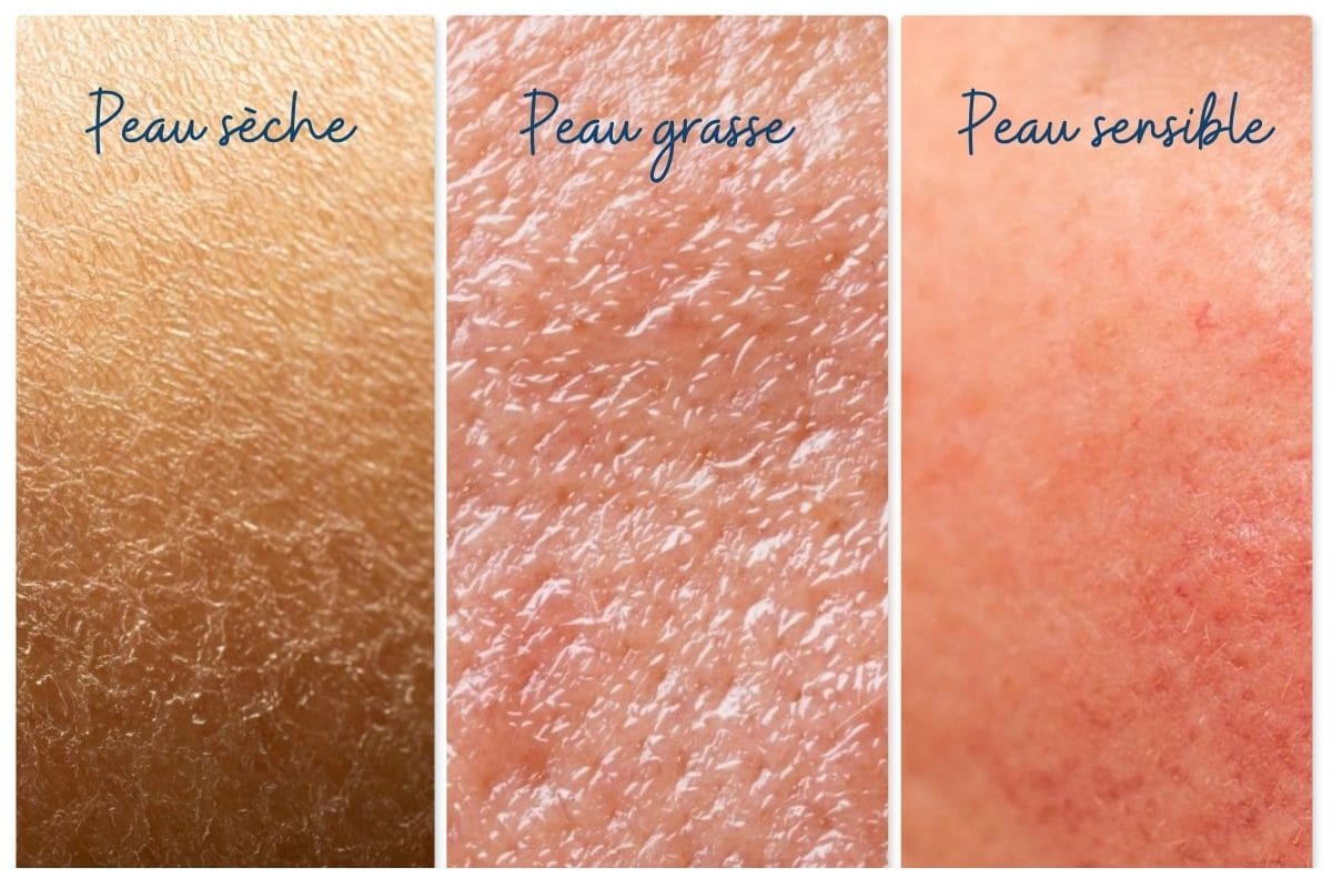 choisir sa creme hydratante en fonction de son type de peau
