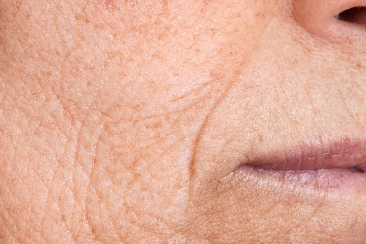 Vieillissement cutané : pourquoi réparer sa peau est aujourd'hui aussi important que l'hydrater peau fatiguee qui recupere moins vite